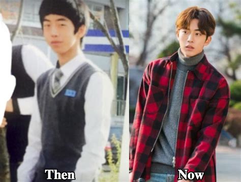 Nam Joo Hyuk Plastic Surgery Before And After Photos