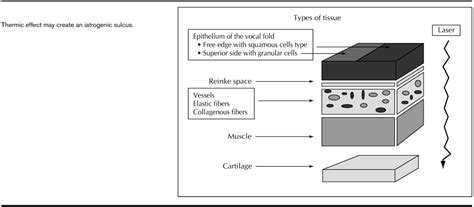 Surgical Management Of Nonneoplastic Vocal Fold Lesions Las