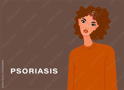 Psoriasis Awareness Psoriasis Affected Area Of The Skin