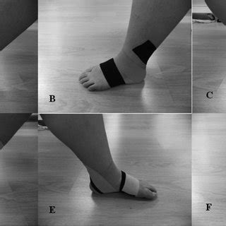 (PDF) Effects of ankle eversion taping using kinesiology tape in a ...