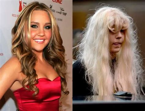 7 Fotos impactantes de celebridades antes y después de las drogas