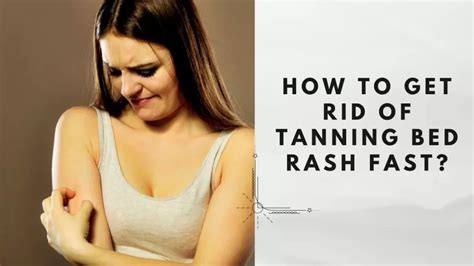 Tanning Bed Rash Causes And Get Rid Of Fast