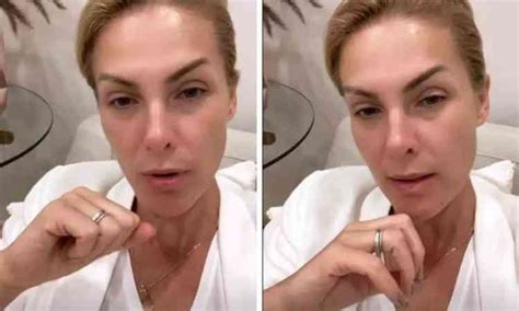 Ana Hickmann Desabafa Sobre Problemas Ex Marido Estresse Emocional