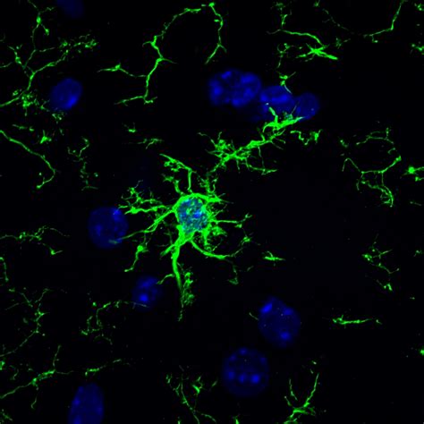 Microglia glow green with Iba1 staining - April Image Contest ...