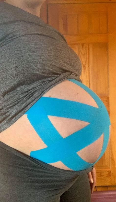 How To Kinesio Tape Pregnant Belly And When To Start Artofit