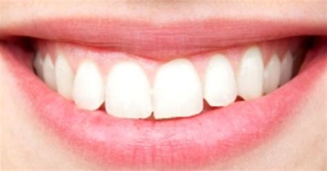 Receding Gums Causes Treatments And Tips For Prevention Facty Health