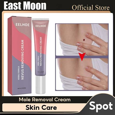 Eelhoe Herbal Formula Nevus Removal Cream Gram Wart Ointment Hand Foot