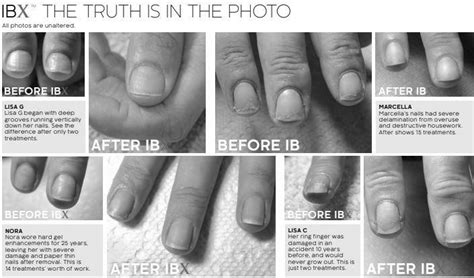 How can I treat paper thin fingernails? | Yin & Yang