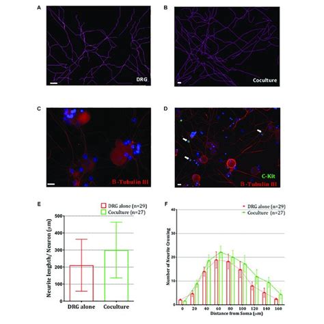 Knockdown Of Cadm In Mast Cells Inhibits Their Adhesion To Sensory