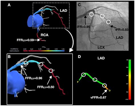 Frontiers Case Report Invasive And Non Invasive Hemodynamic