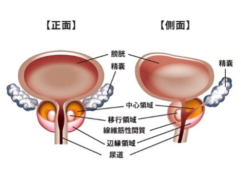 前立腺がんとは？症状や原因、治療法、診療費用について詳しく解説 きむら泌尿器・腎臓内科クリニック