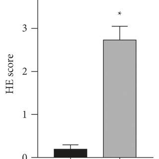 MiR 216b 5p Was Downregulated And FAS Was Upregulated In EAE N 15