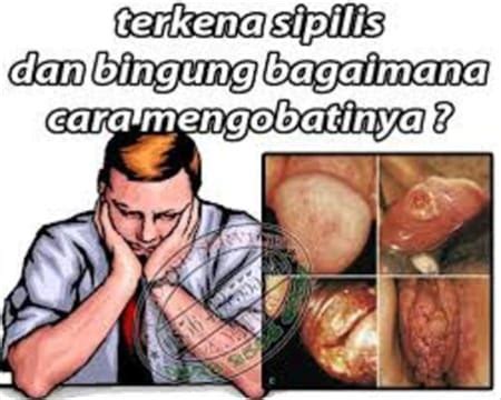 Obat Kelamin Ampuh Daptar Obat Kencing Nanah Di Apotik Terdekat