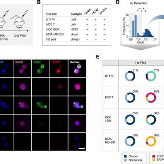 In vivo studies using human breast cancer xenograft models. (A ...