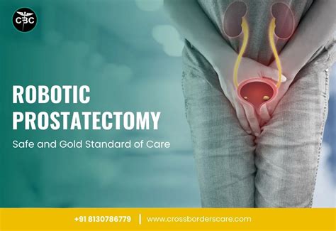 Robotic Prostatectomy Safe And Gold Standard Of Care