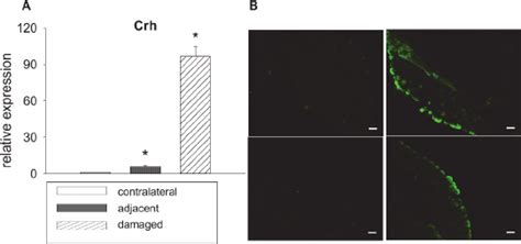 Crh Expression In Drg Neurons After Cci A Mrna From Drg Neurons