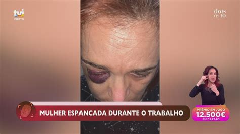 Promotora De Vendas Foi Agredida Enquanto Trabalhava Mas A Seguradora