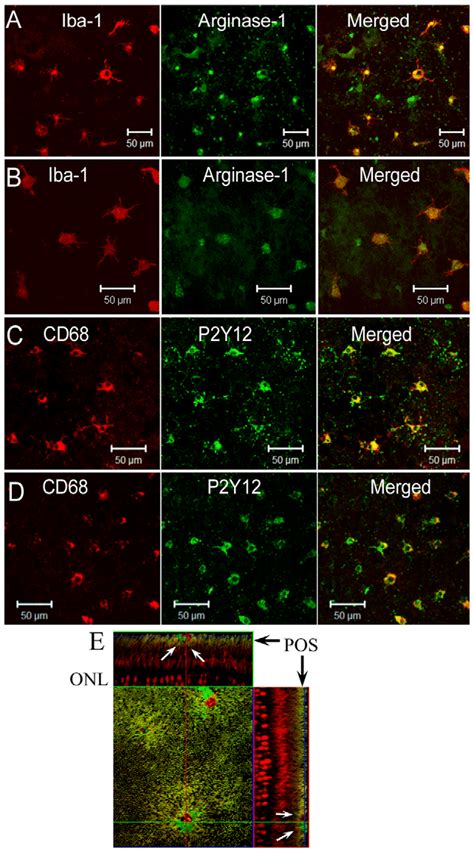 Phenotype Of Subretinal Macrophage Microglia Rpe Choroidal Flatmounts