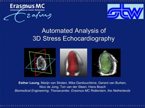 Ppt Automated Analysis Of D Stress Echocardiography Powerpoint