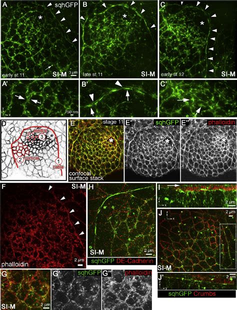 Super Resolution Microscopy Reveals Distinct Pools Of Myosin Ii During