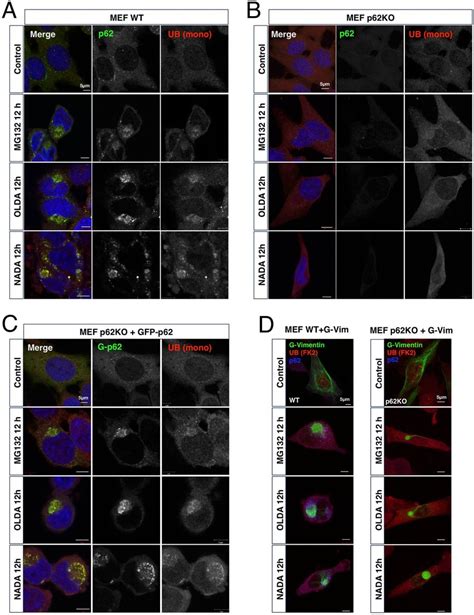 P62sqstm1 Is Essential For Ubiquitinated Protein Accumulation In