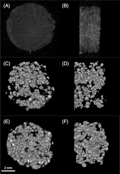 Microcomputed Tomography Ct Analysis Of The Particle Distribution