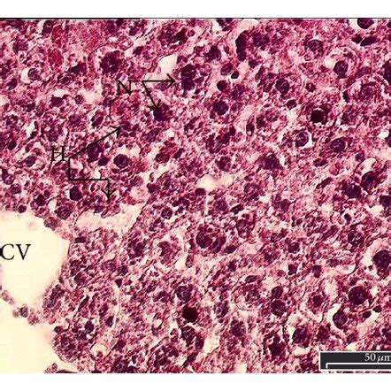 Photomicrograph Of A Section Of Liver Of Rat Obtained From Different