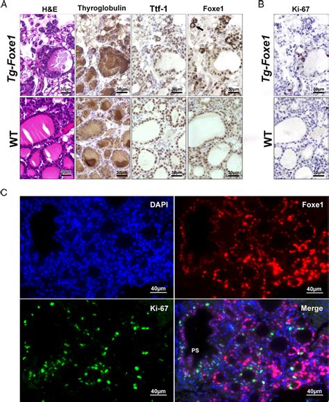 Functional Differentiation And Proliferative Status Of Thyroid Cells In