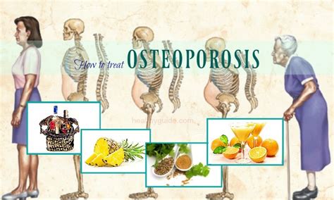 33 Tips How To Treat Osteoporosis Pain Of The Hip Knee Spine Naturally