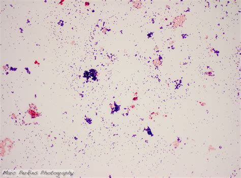 Gram Stain Demonstration Slide 400x 1 Marc Perkins Photography