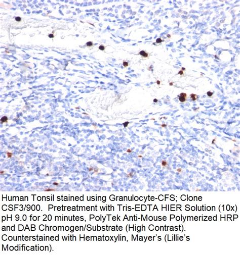 Granulocyte-Colony Stimulating Factor (G-CSF); Clone CSF3/900 ...