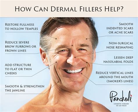 Dermal Filler Injections for Men - Las Vegas - Dr. Pancholi