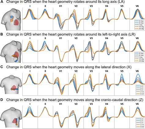 Frontiers MRI Based Computational Torso Biventricular Multiscale