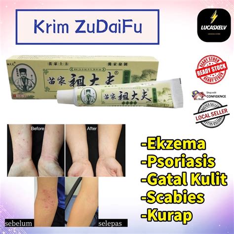 Zudaifu Natural Chinese Herbs Cream For Eczema Dermatitis Psoriasis