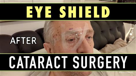 How To Apply The Eye Shield After Cataract Surgery Eye Shield