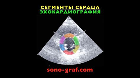 212 - Эхокардиография - Сегменты сердца - YouTube