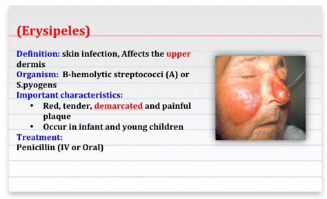 Erysipelas Vs Cellulitis