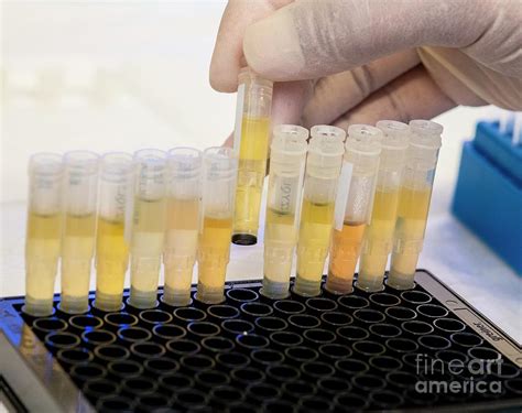 patient samples  covid  testing photograph  cdc james gathany