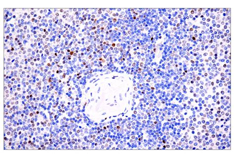 Toxtox2 E6i3q Rabbit Mab Bsa And Azide Free Cell Signaling