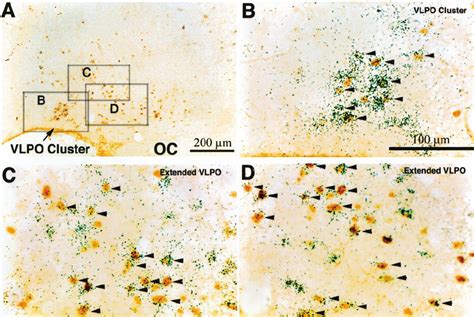 Photomicrographs Showing Dual Labeling Of Fos Brown Immunostaining