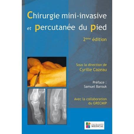 Chirurgie Mini Invasive Et Percutan E Du Pied Cyrille Cazeau