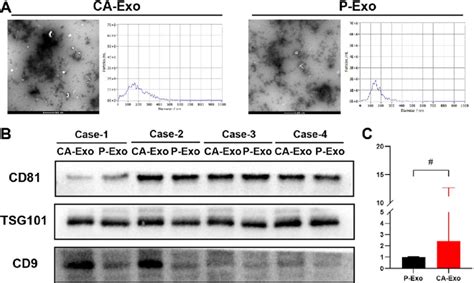 Differential Expression Analysis Of Mir P In Clinical Samples A