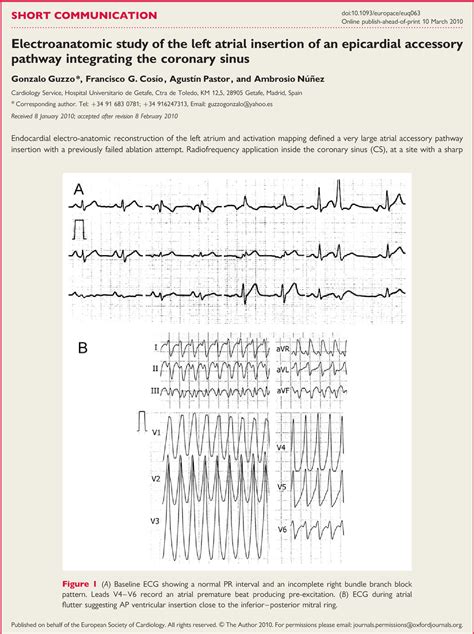 Figure 1 From Electroanatomic Study Of The Left Atrial Insertion Of An