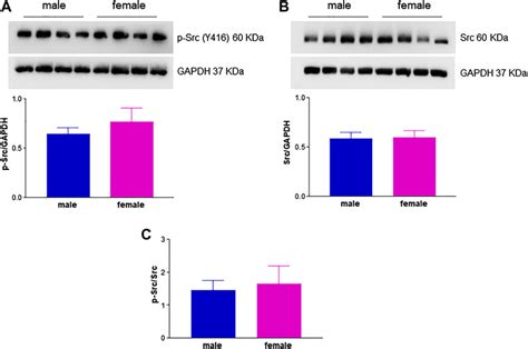 Frontiers Sex Differences In The Pro Angiogenic Response Of Human