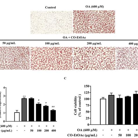 Co Etoac Decreases Oleic Acid Oa Induced Lipid Accumulation In Fl83b