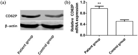 Comparison Of Cd P Mrna Expressions In Pbmcs Between Two Groups A