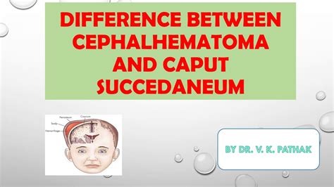 DIFFERENCE BETWEEN CEPHALHEMATOMA AND CAPUT SUCCEDANEUM #CEPHALHEMATOMA ...