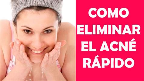 Acne Eliminar Rapido Skin Beauty Hacks Skin Care