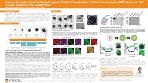 STEMdiff Choroid Plexus Organoid Maturation Kit STEMCELL Technologies