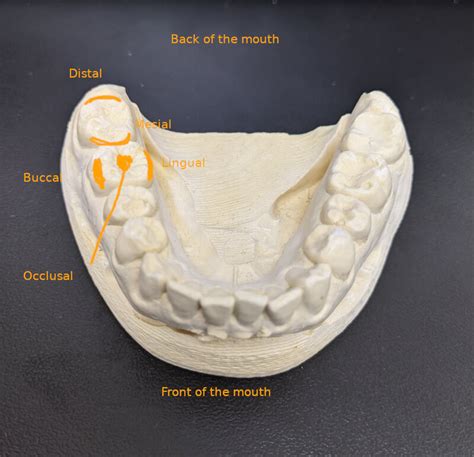 Dental Filling Procedure Step By Step Afterva Oral Health Library